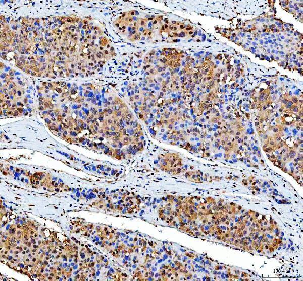 a10062 1 rprd1a primary antibodies ihc testing 3