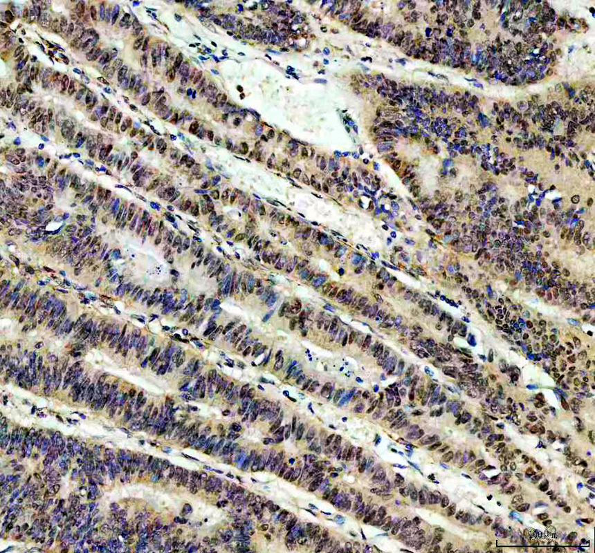 a10062 1 rprd1a primary antibodies ihc testing 3_1