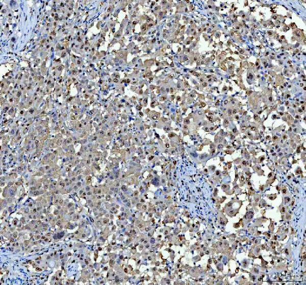 a10062 1 rprd1a primary antibodies ihc testing 4
