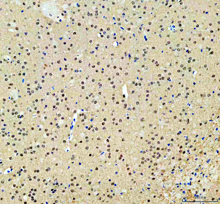 a10062 1 rprd1a primary antibodies ihc testing 4_1