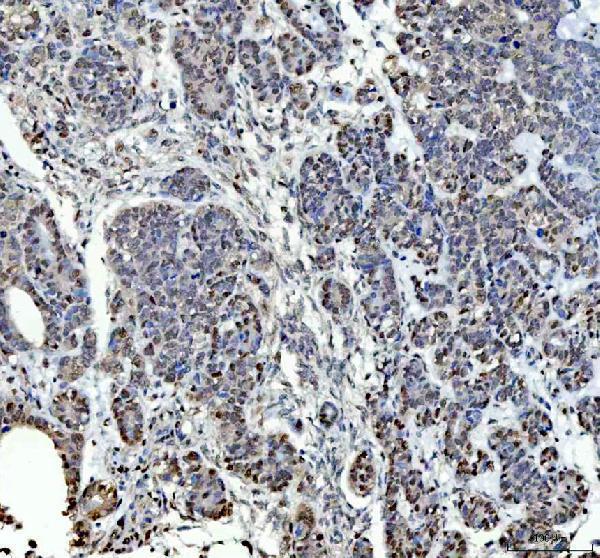 a10062 1 rprd1a primary antibodies ihc testing 5