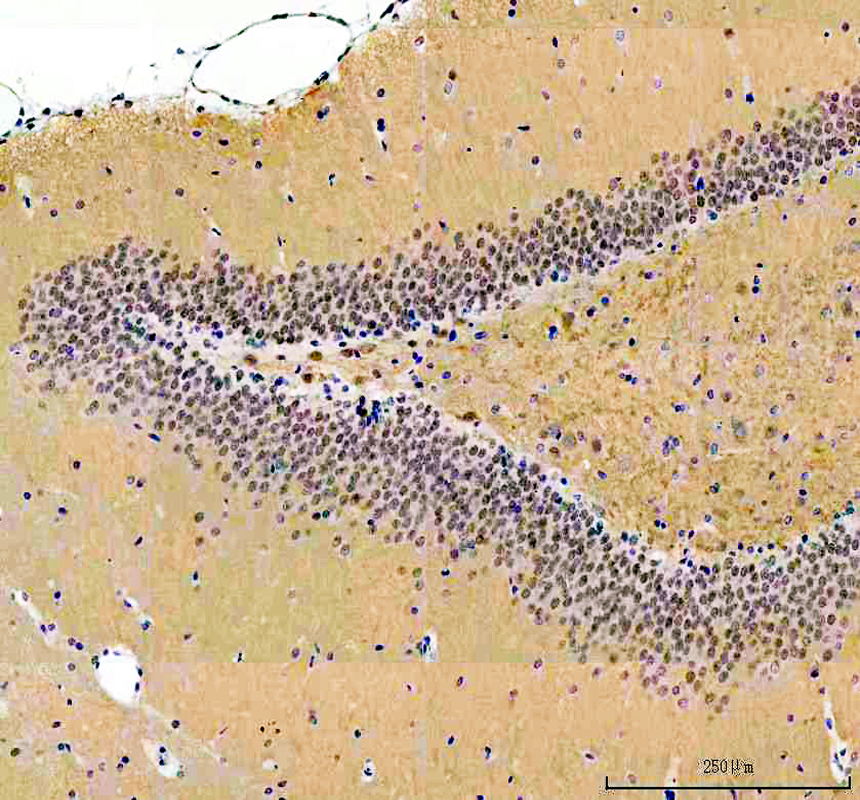 a10062 1 rprd1a primary antibodies ihc testing 5_1