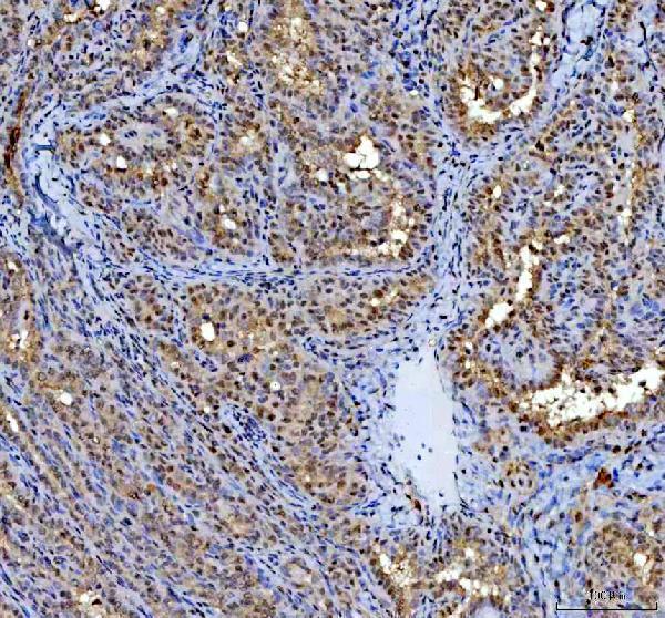 a10062 1 rprd1a primary antibodies ihc testing 6
