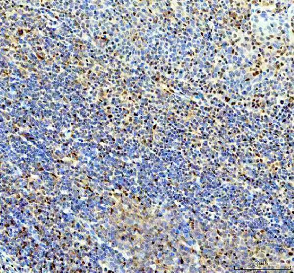 a10062 1 rprd1a primary antibodies ihc testing 7