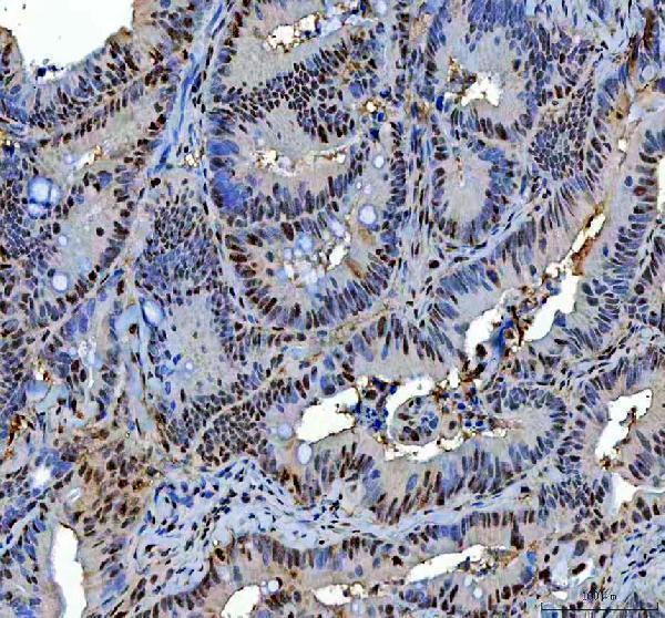 a10062 1 rprd1a primary antibodies ihc testing 8