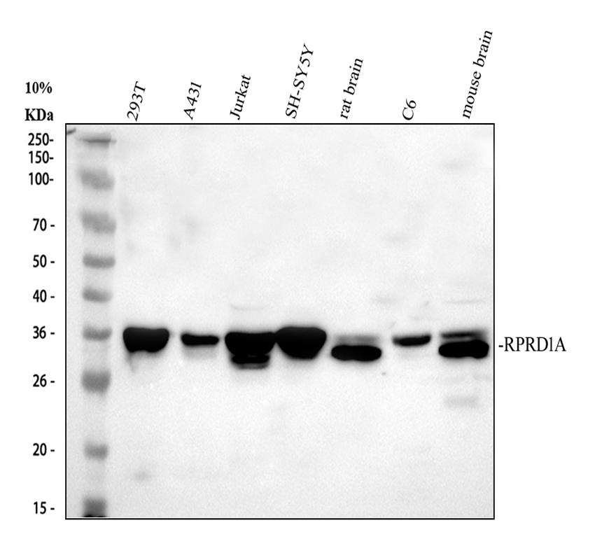 Western blot analysis of P15RS/RPRD1A using anti-P15RS/RPRD1A antibody (A10062-1)