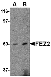 Western blot analysis of FEZ2 in mouse brain tissue lysate with FEZ2 antibody at (A) 0