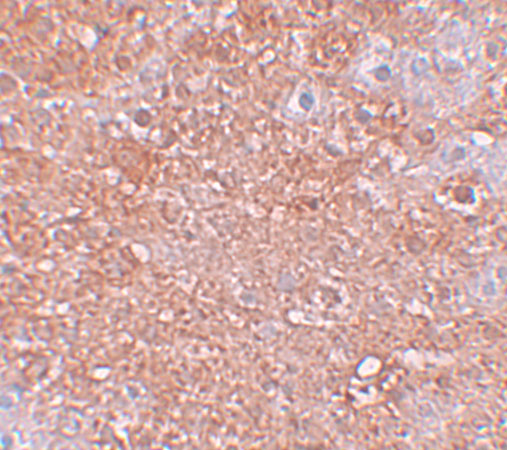 a10066 slc39a12 primary antibodies ihc testing 2