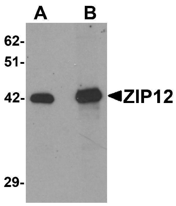 a10066 slc39a12 primary antibodies wb testing 1