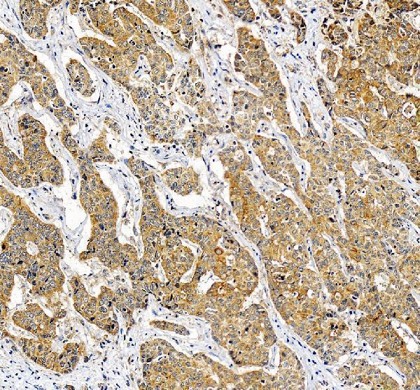 IHC analysis of RPS21 using anti-RPS21 antibody (A10068-2)