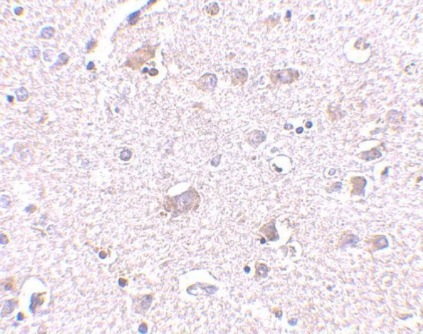 a10069 1 cdnf primary antibodies ihc testing 2