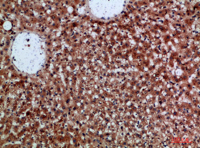 Immunohistochemical analysis of paraffin-embedded human-liver, antibody was diluted at 1:200