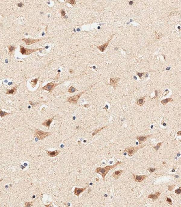 a10072 1 anti ap1m1 antibody center ihc p leica testing 6