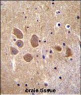 a10072 1 anti ap1m1 antibody center ihc p testing 5