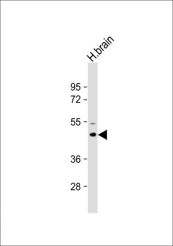 Anti-AP1M1 Antibody (Center) at 1:2000 dilution + Human brain lysateLysates/proteins at 20 µg per lane
