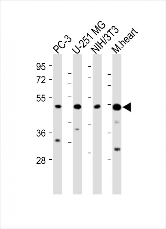 All lanes : Anti-AP1M1 Antibody (Center) at 1:2000 dilutionLane 1: PC-3 whole cell lysateLane 2: U-251 MG whole cell lysateLane 3: NIH/3T3 whole cell lysateLane 4: Mouse heart lysateLysates/proteins at 20 µg per lane