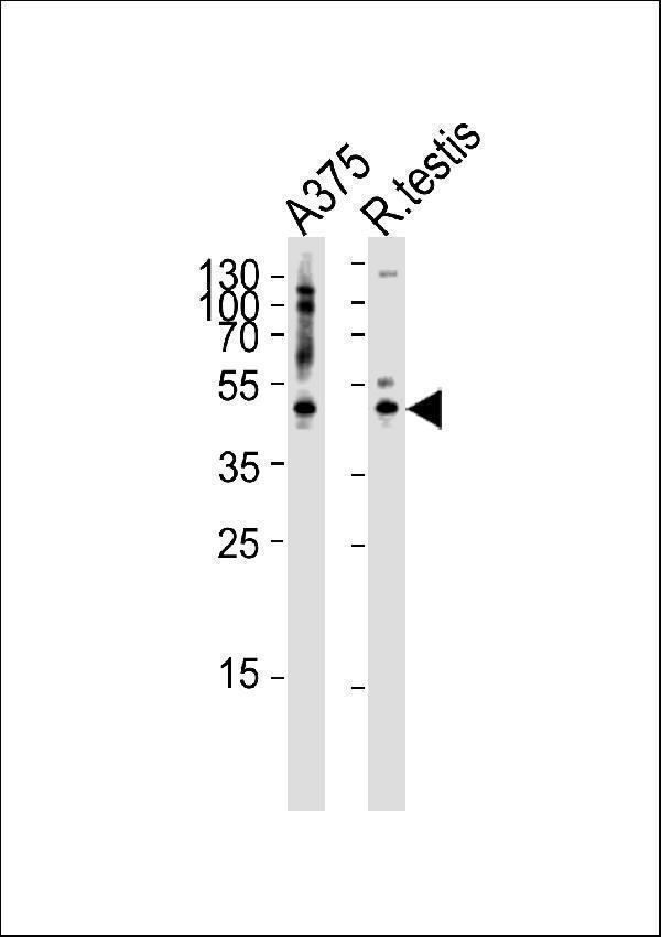 a10072 1 anti ap1m1 antibody center wb testing 4