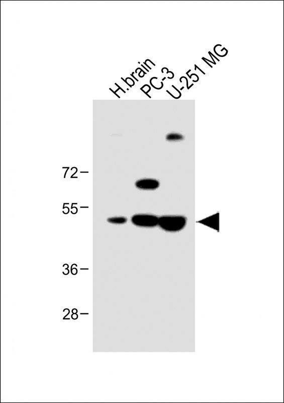 All lanes : Anti-AP1M1 Antibody (Center) at 1:1000 dilutionLane 1: Human brain lysateLane 2: PC-3 whole cell lysateLane 3: U-251 MG whole cell lysateLysates/proteins at 20 µg per lane