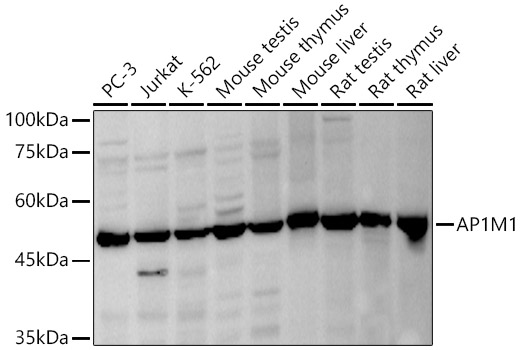 Western blot analysis of various lysates, using AP1M1 antibody  at  1:1000 dilution
