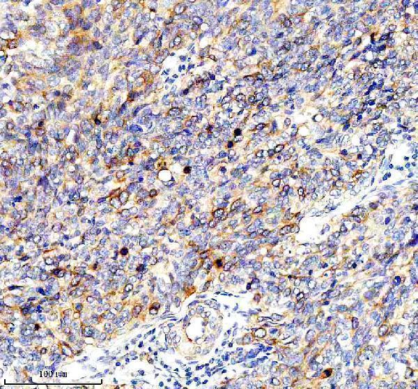 a10074 2 cdca3 primary antibodies ihc testing 1
