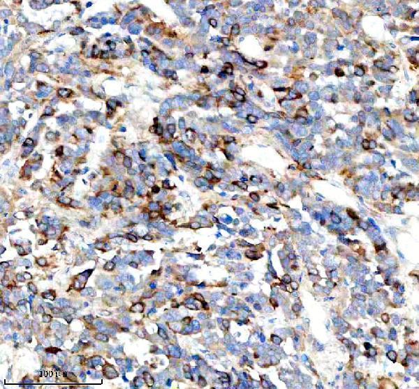 a10074 2 cdca3 primary antibodies ihc testing 2