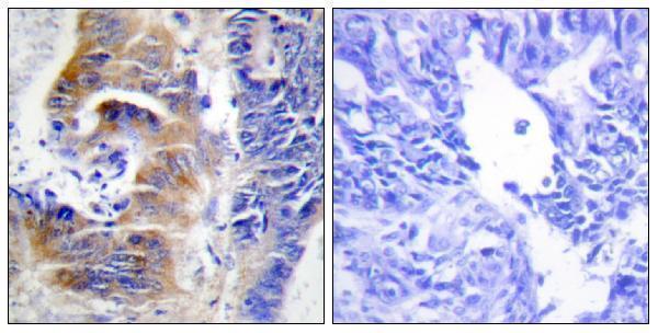 a10074 cdca3 primary antibodies ihc testing 1