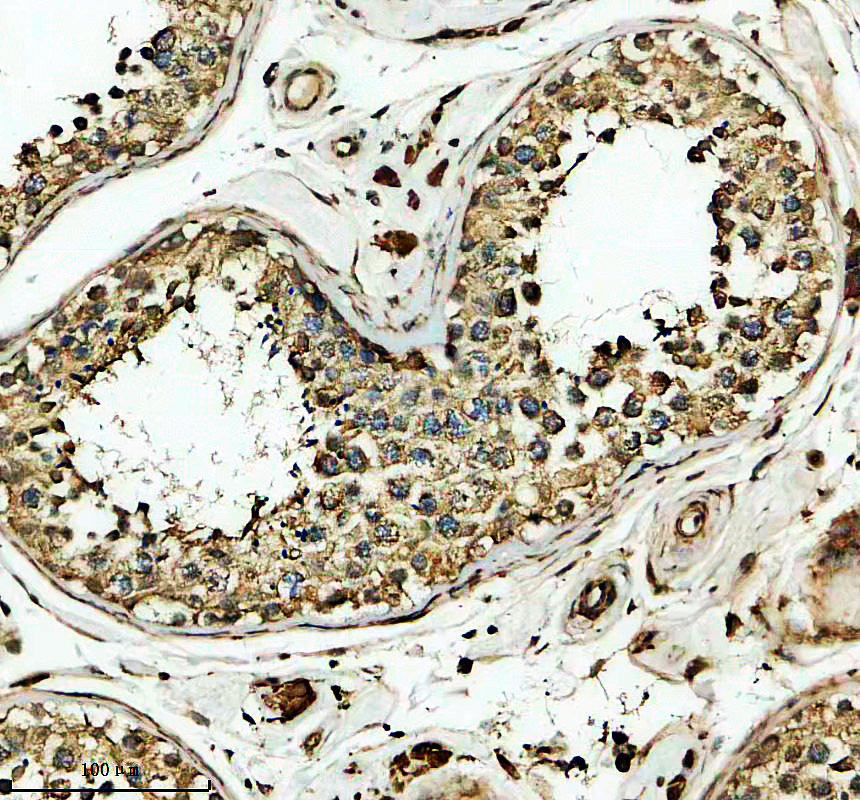a10075 1 lman2 primary antibodies ihc testing 1