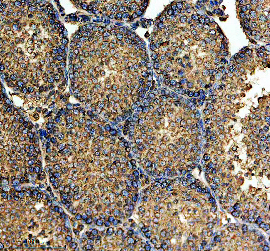 a10075 1 lman2 primary antibodies ihc testing 2