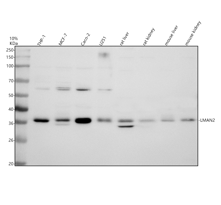a10075 1 lman2 primary antibodies wb testing 1