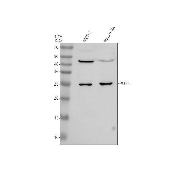 Western blot analysis of POP4 using anti-POP4 antibody (A10082-2)