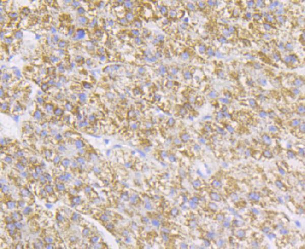 Immunohistochemical analysis of paraffin-embedded human liver tissue using anti-P2Y6 antibody