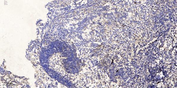 a10088 1 mapk15 primary antibodies ihc testing 4