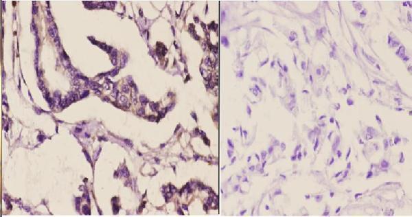 a10088 2 mapk15 primary antiboties ihc testing 2