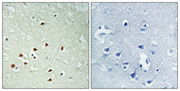 a10088t175y177 mapk15 primary antibodies ihc testing 1