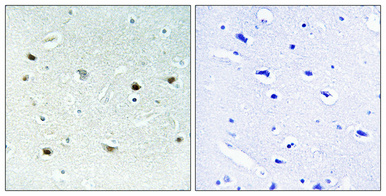 Immunohistochemical analysis of paraffin-embedded Human brain