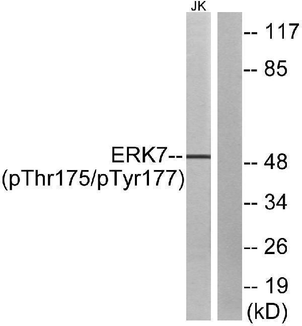 Western blot analysis of lysates from Jurkat cells, using ERK8 (Phospho-Thr175+Tyr177) Antibody