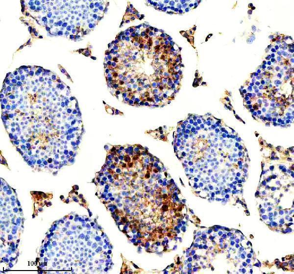 IHC analysis of HERC4 using anti-HERC4 antibody (A10089-1)
