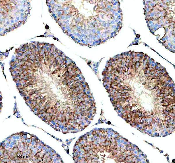 a10089 1 herc4 primary antibodies ihc testing 3