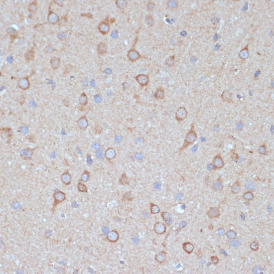 a10090 copg2 primary antiboties ihc testing 2