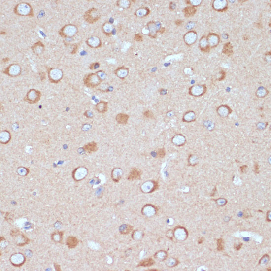 a10090 copg2 primary antiboties ihc testing 3