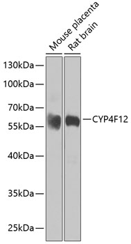 a10093 cyp4f12 primary antiboties wb testing 1