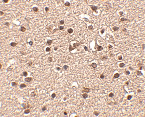 a10097 dact2 primary antibodies ihc testing 2