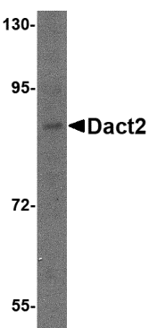 a10097 dact2 primary antibodies wb testing 1