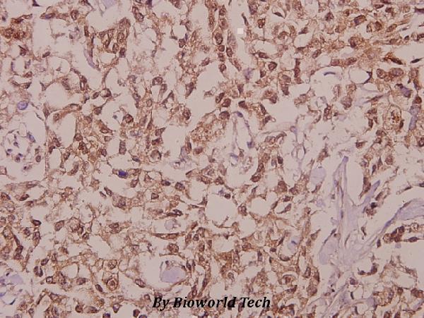 a10099 ddx19b primary antiboties ihc testing 2