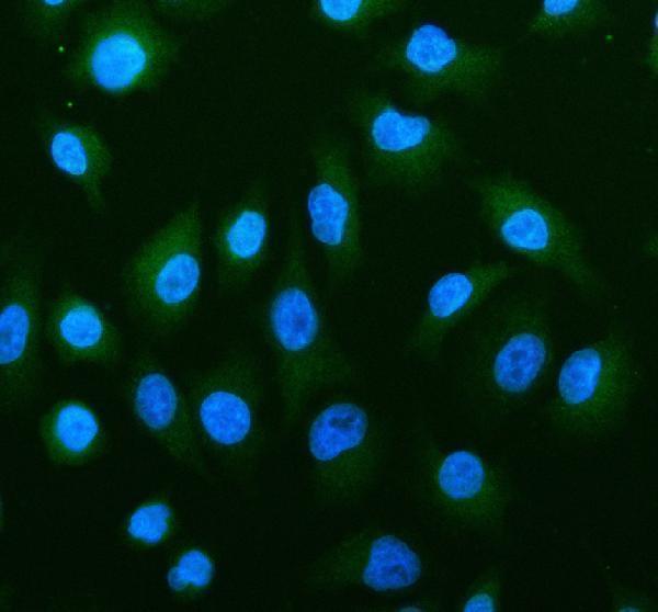IF analysis of PMVK using anti-PMVK antibody (A10103)