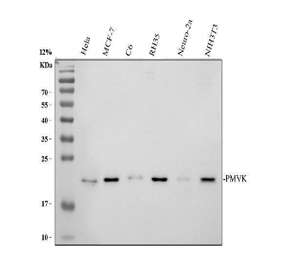 Western blot analysis of PMVK using anti-PMVK antibody (A10103)