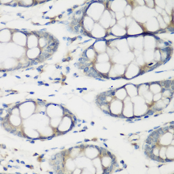 Immunohistochemistry of paraffin-embedded human colon using TNNC2 antibody  at dilution of 1:200 