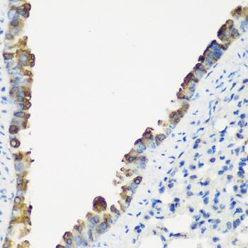 Immunohistochemistry of paraffin-embedded mouse lung using TNNC2 antibody  at dilution of 1:200 