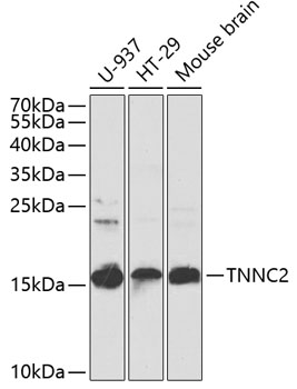 Western blot analysis of extracts of various cell lines, using TNNC2 antibody  at 1:1000 dilution