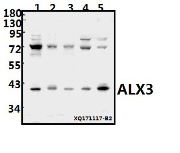 Western blot (WB) analysis of ALX3 (R203) pAb at 1:1000 dilution
Lane1:HepG2 whole cell lysate(40ug)
Lane2:Hela whole cell lysate(40ug)
Lane3:MCF-7 whole cell lysate(40ug)
Lane4:PMVEC whole cell lysate(40ug)
Lane5:AML-12 whole cell lysate(40ug)
